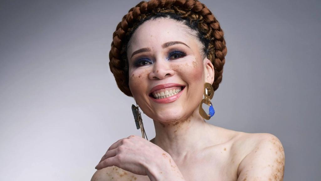 Women in Charge: An exclusive conversation with Leleti Khumalo on vitiligo and self-acceptance